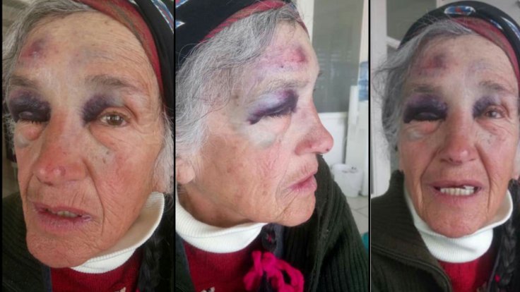 75 yaşındaki Perihan Pulat’ı darp eden polise 3 bin lira para cezası