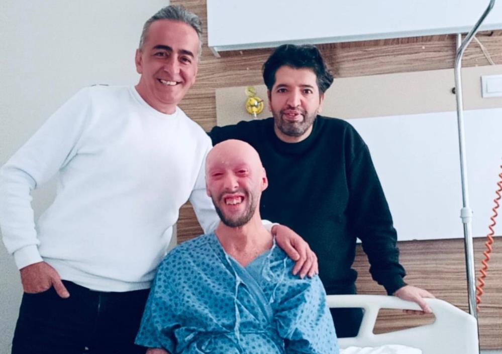 Şemdinlili  iktiyozis hastası tedaviye cevap verdi