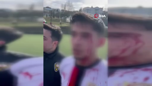 Maç sonrası saha içi savaş alanına döndü, 3 futbolcu hastanelik oldu