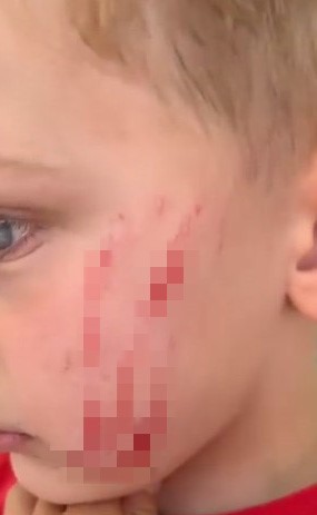 Van’da sokakta oynayan çocuğa saldırı: O anlar kamerada