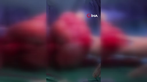 İstanbul’da başarılı operasyon: 60 santimetre çapındaki miyom rahim korunarak çıkarıldı